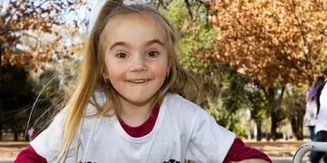 Juanita Ghiotti Dávila, la niña que fue operada 4 veces de sus manitos en España