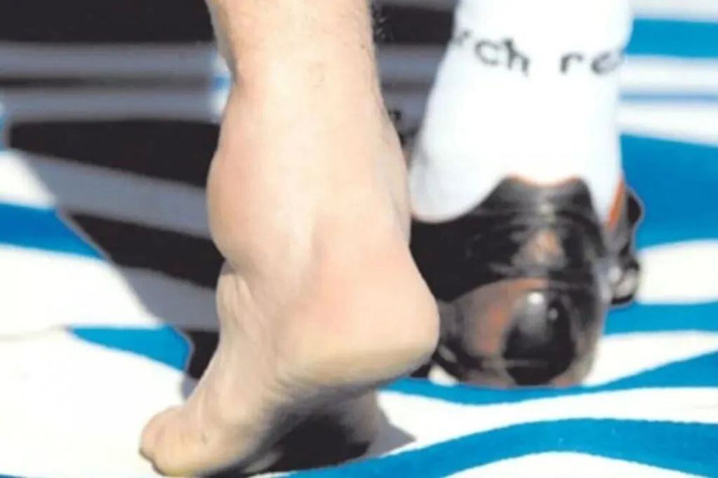 El tobillo de Juan Marcelo Ojeda siempre es confundido con el de Diego Maradona.