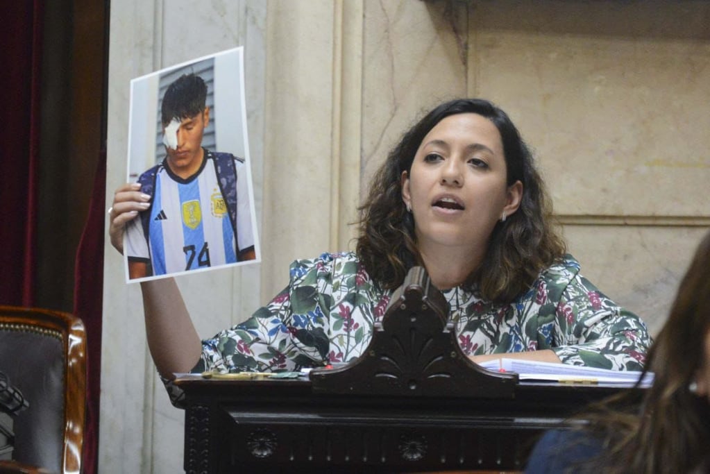 La diputada nacional del Frente de Todos, Leila Chaher solicitó una cuestión de privilegio y habló exhibiendo una fotografía de Mijael Lian Lamas, el manifestante que perdió un ojo a causa de una bala de goma, en Purmamarca.