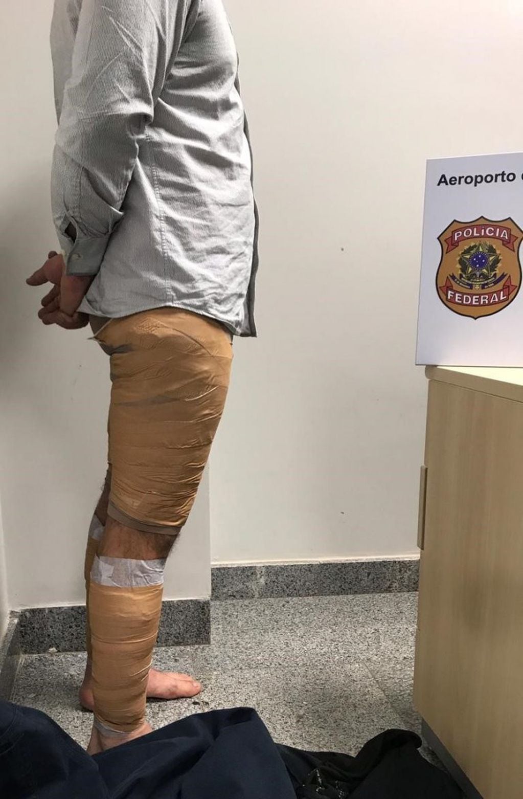 Los vendajes cubrían casi la totalidad de sus piernas. Debajo llevaba cocaína. (Policía Federal de Brasil)