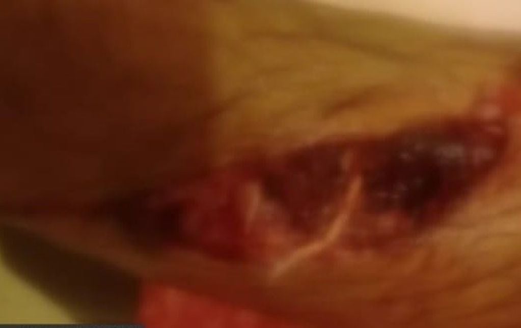 Así quedó la pierna de Orlando tras el ataque del pitbull. (Captura de pantalla)