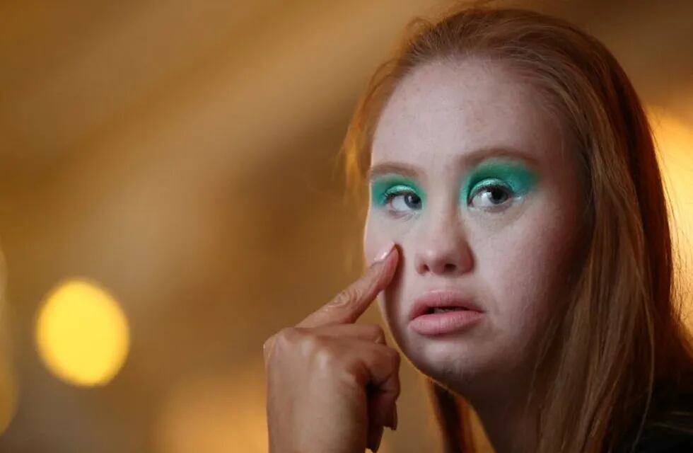 Model Madeline Stuart, who has Down's syndrome, is prepared backstage before the Colleen Morris Presentation of the Spring/Summer 2019 collection during London Fashion Week in London, Britain, September 15, 2018. REUTERS/Hannah McKay  SEARCH \