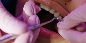 El móvil odontológico atiende pacientes hasta fin de mes en CoFrutHoS