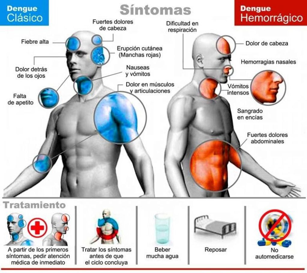 Síntomas de dengue.