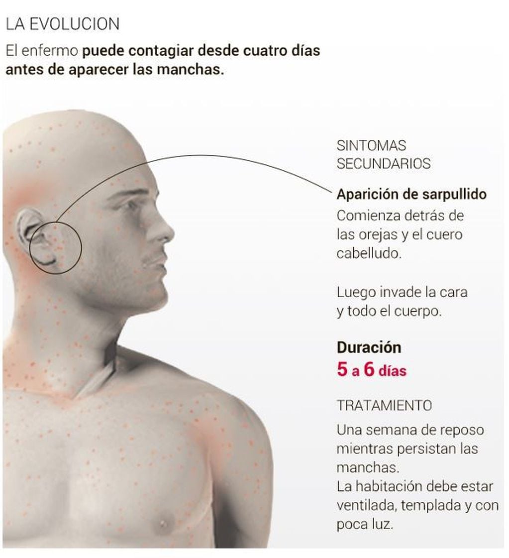 Evolución de la enfermedad. Fuente: Clarín.