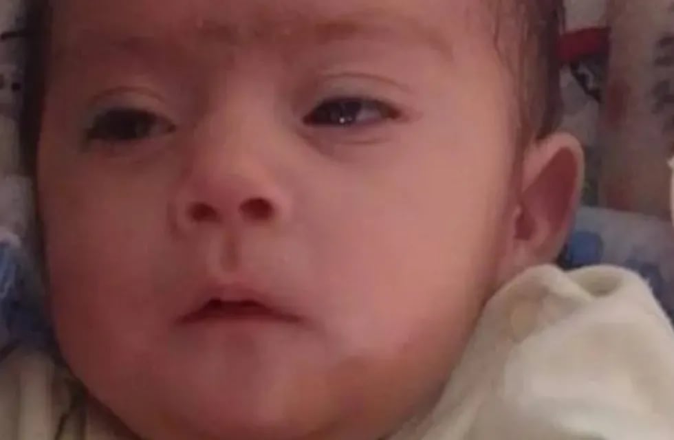 Tobías Valentino Viscarra, el bebé de tres meses que necesita acceder a un tratamiento médico por problemas en el corazón.