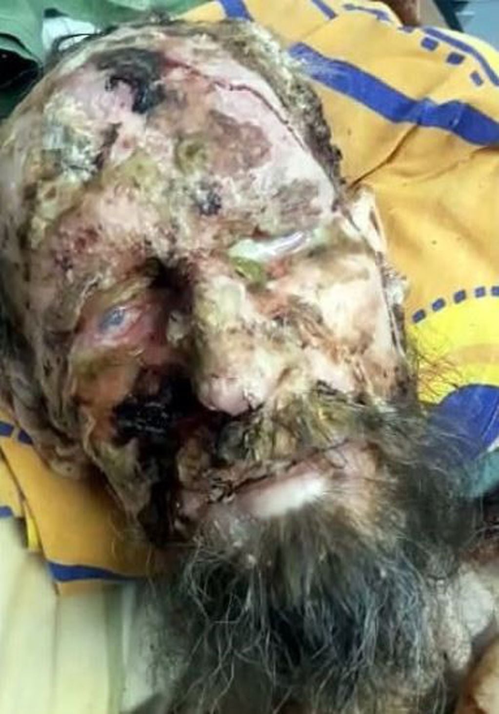 Rusia: un hombre con la columna fracturada sobrevivió un mes atrapado en la guarida de un oso (Foto: The Siberian Times)