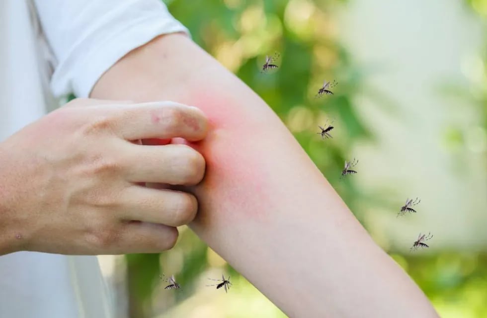 El truco infalible, natural y económico para alejar a los mosquitos y evitar que te piquen.