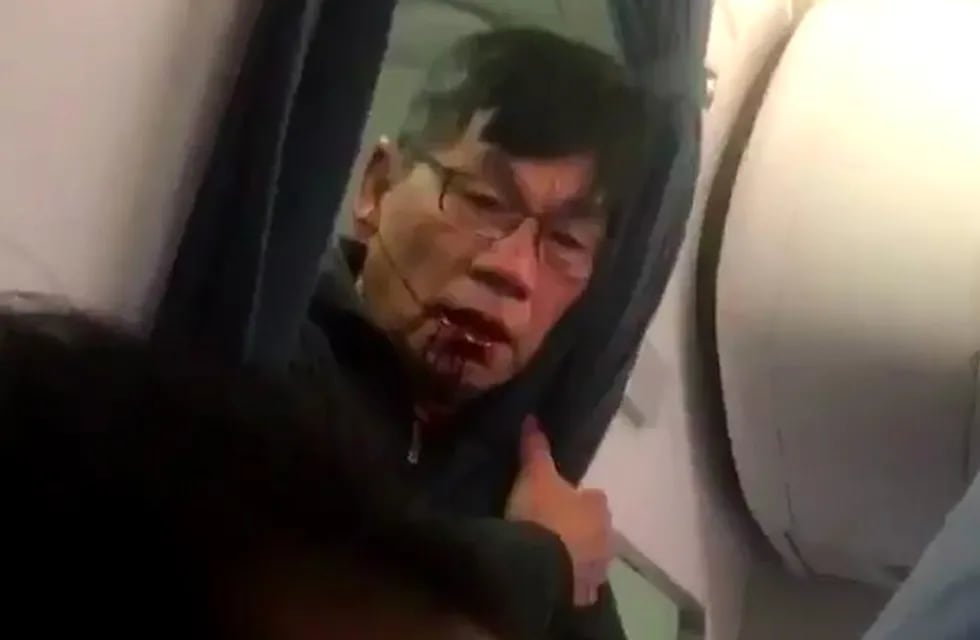 David Dao, el pasajero expulsado de un vuelo de UA.