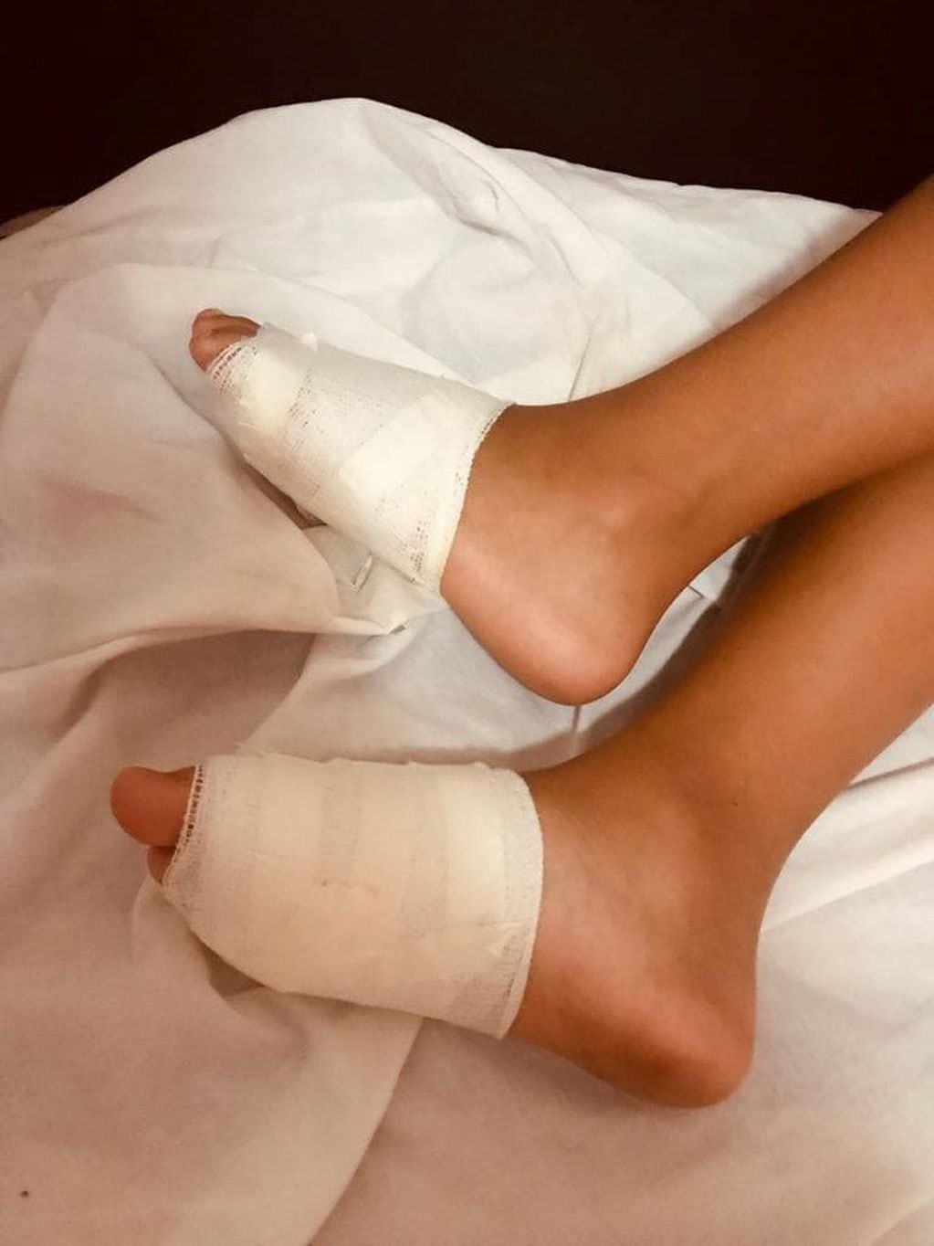Los pies heridos de la pequeña de 10 años