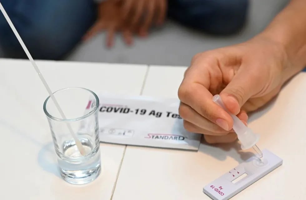 Autotest: Las farmacias deberán informar a quien venden el test para realizar un seguimiento. Foto: AP.