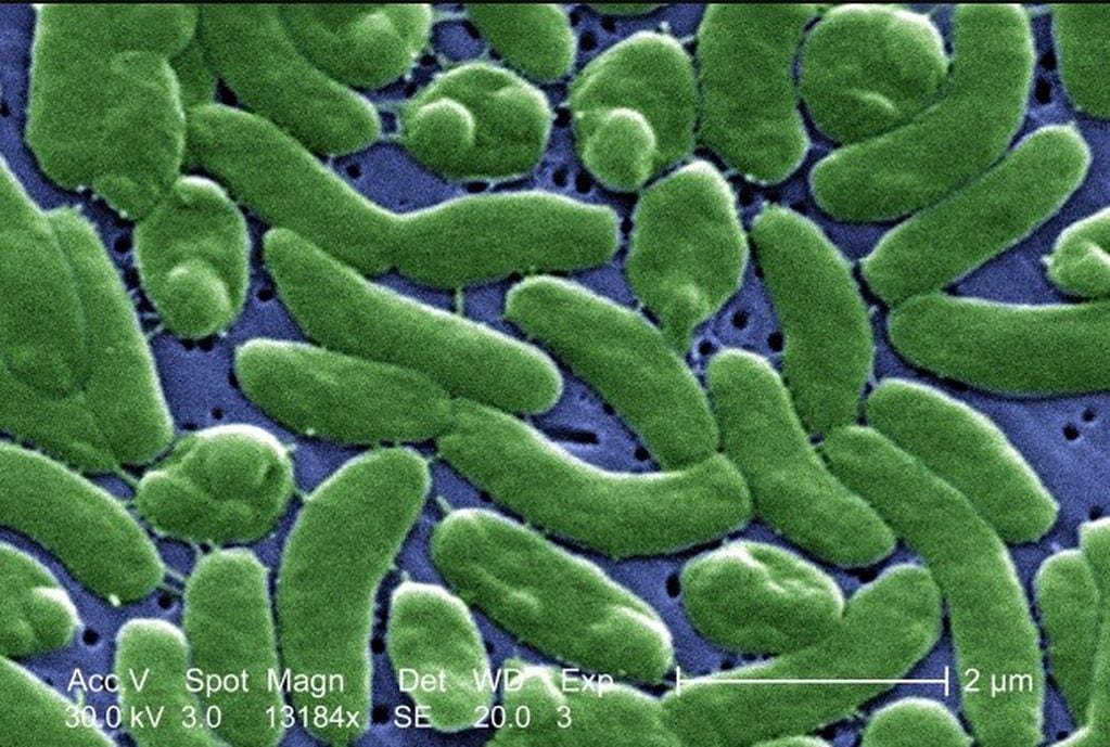La peligrosa bacteria Vibrio vulnificus. (Wikipedia)