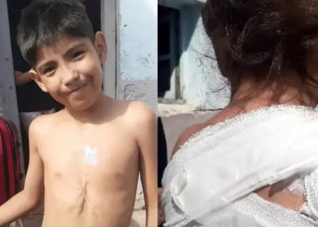Agustín, el niño de 10 años que salvó a su hermanita de 2 años mientras se incendiaba la casa.