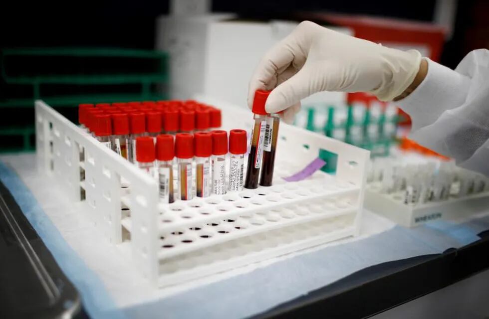 FILE PHOTO: A health worker takes test tubes with plasma and blood samples after a separation process in a centrifuge during a coronavirus disease (COVID-19) vaccination study at the Research Centers of America, in Hollywood, Florida, U.S., September 24, 2020. REUTERS/Marco Bello/File Photo