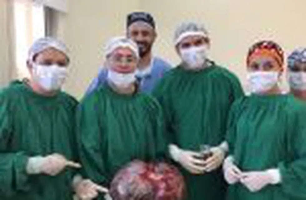 Le extirparon un tumor de 15 kilos a una mujer en Catamarca. (Facebook)