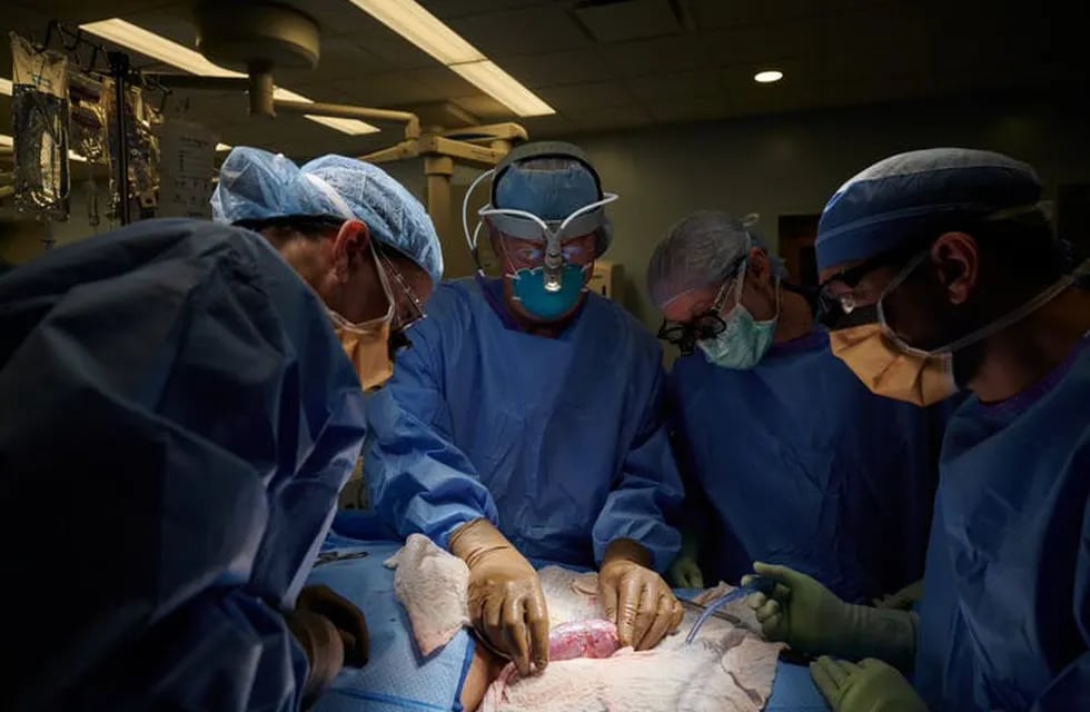En las últimas semanas se conocieron intervenciones de trasplantes de órganos de cerdo en seres humanos, que fueron exitosos. Foto: La Voz.