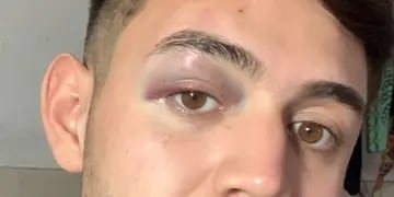 Joven golpeado en un boliche de Carlos Paz