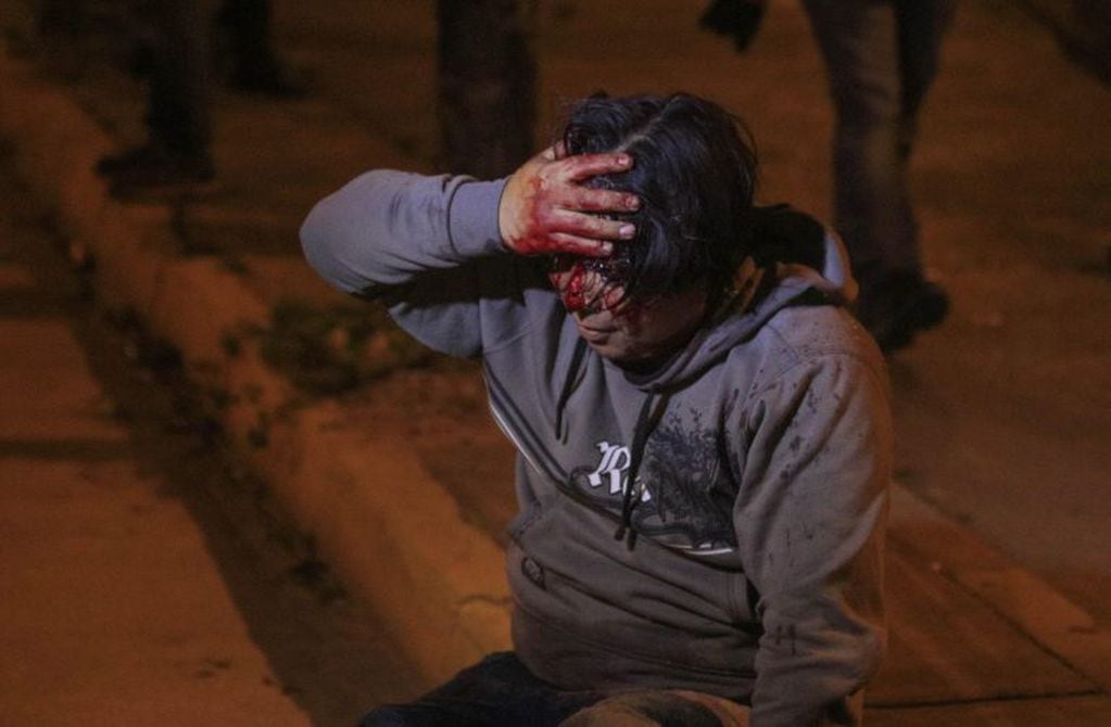 SANTA CRUZ (BOLIVIA).- Un herido sangra durante los enfrentamientos con jóvenes contrarios al presidente Evo Morales, este martes cuando la policía dispersó a grupos que protestaban en el exterior de un mitin del MAS. EFE/Juan Carlos Torrejon