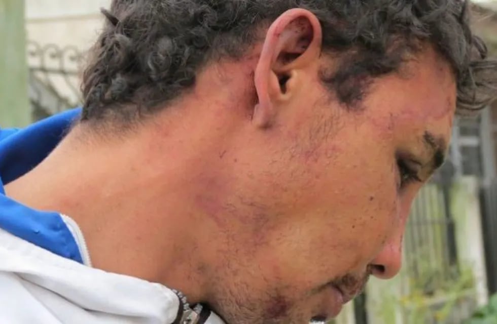 La víctima mostró las lesiones en el rostro producto de la golpiza.