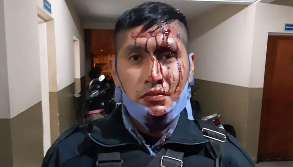 Policía herido tras los enfrentamientos. (El Tribuno)