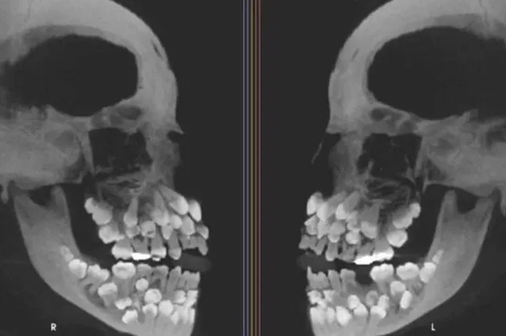 Imágenes de las tomografías difundidas en redes sociales.
