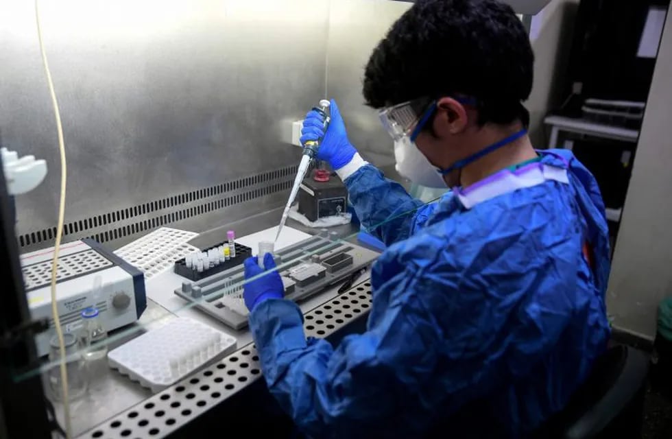 A healthcare worker conducts Polymerase Chain Reaction (PCR) tests at the microbiology lab of the Ramon y Cajal Hospital in Madrid on April 14, 2020. - Spain's death toll from the novel coronavirus topped 18,000, as the rise in new infections dropped to its lowest level since the country imposed a nationwide lockdown last month. (Photo by OSCAR DEL POZO / AFP)