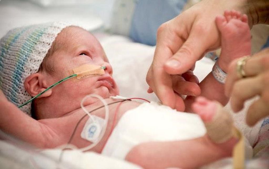 La visión de un bebé prematuro (Imagen ilustrativa)