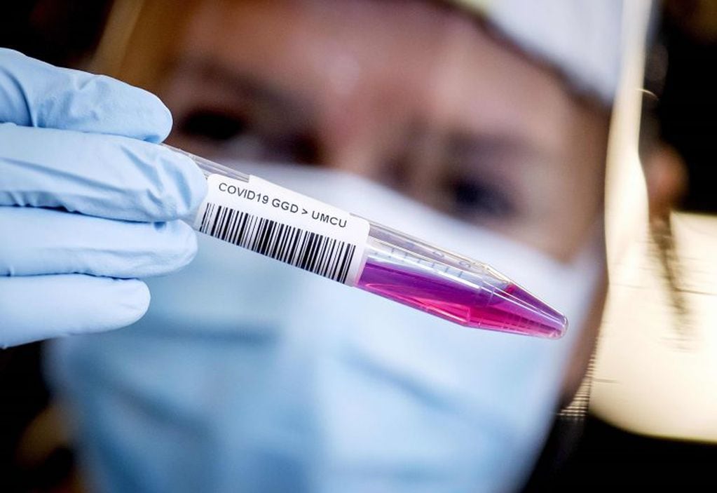 Test de Coronavirus. (Photo by Koen Van WEEL / ANP / AFP) / Netherlands OUT  test coronavirus   analisis