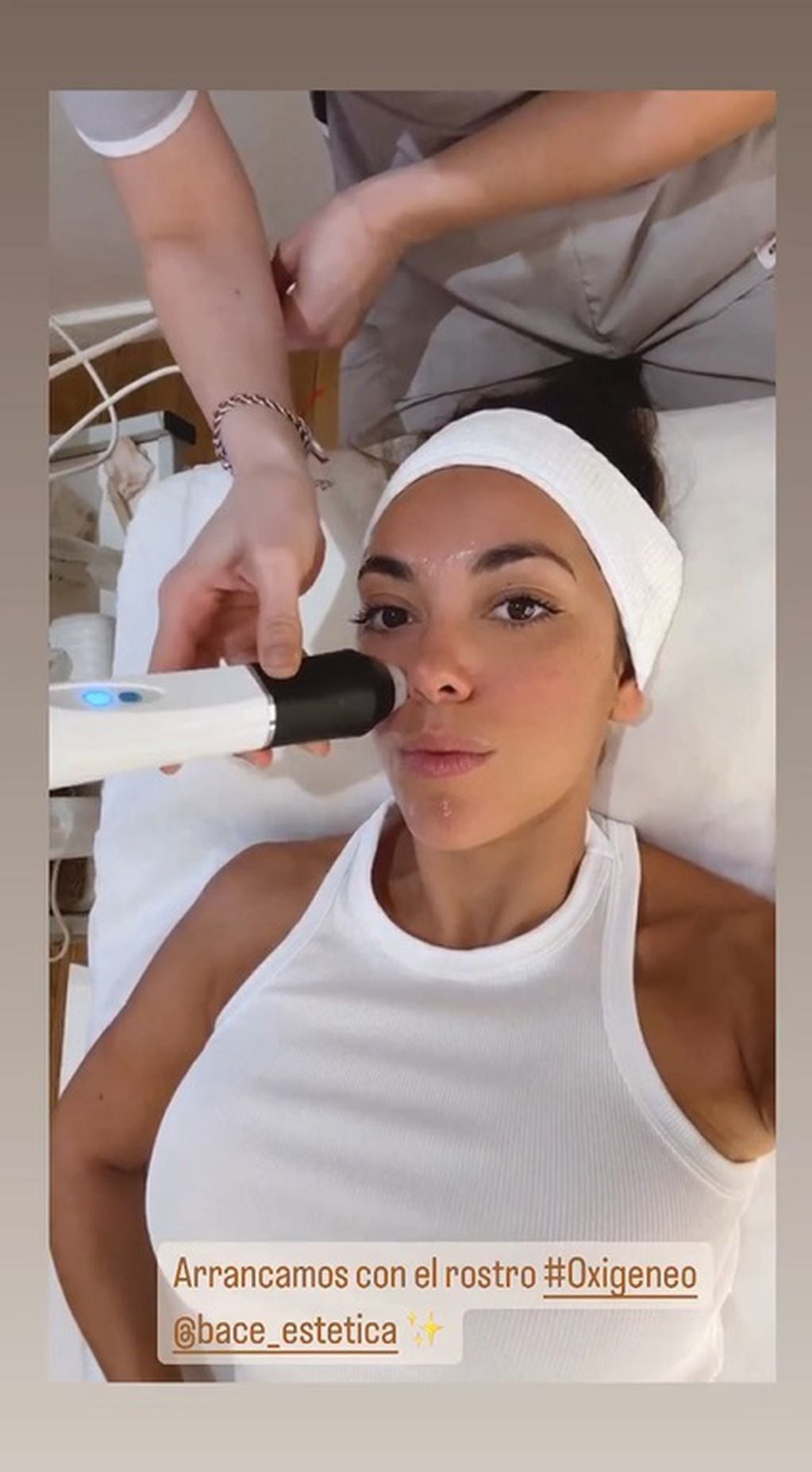 La modelo se sometió a un tratamiento facial y lo mostró en redes sociales / Foto: Instagram