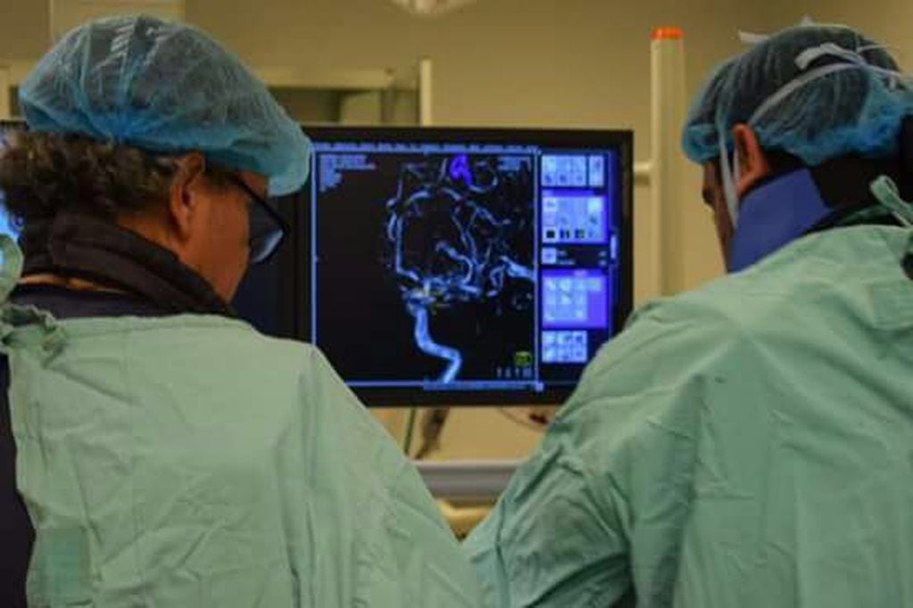 Cirugía de aneurisma cerebral por vía endovascular