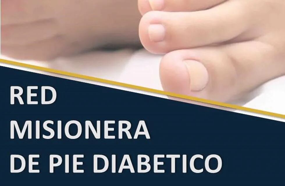 Lanzan el 4 de julio de 2019 la Red Misionera de Pie Diabético. (Hospital Madariaga)