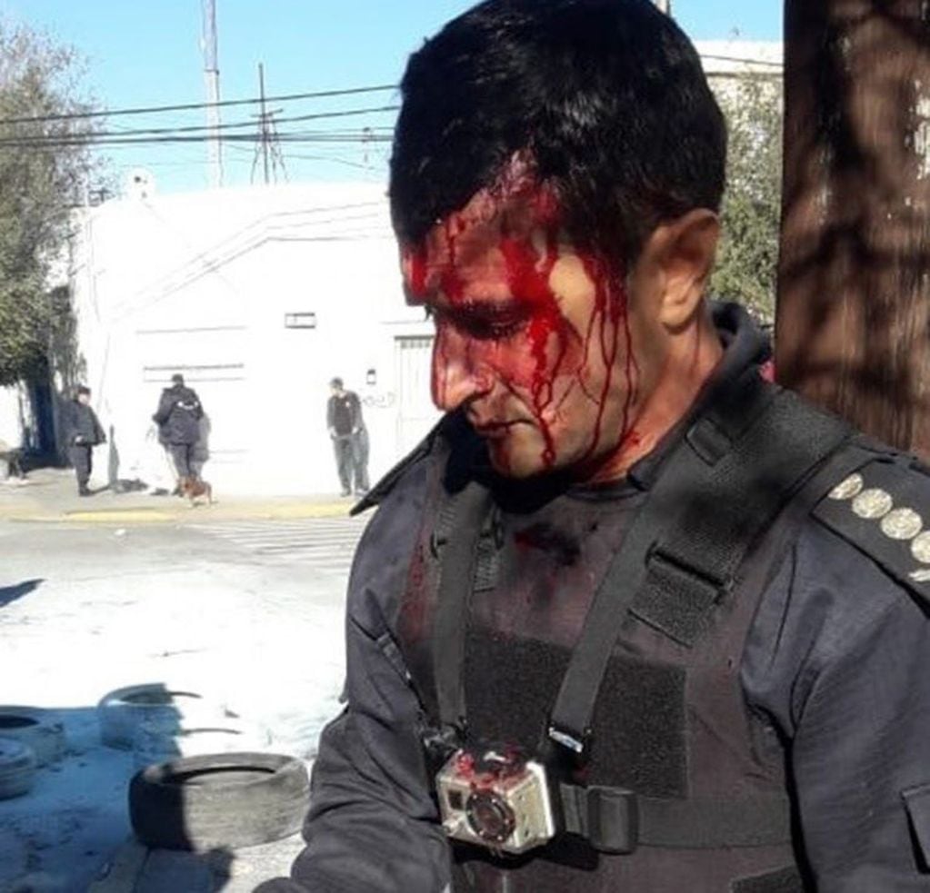 El jefe de la Policía, Miguel Gómez, herido el día del episodio.
