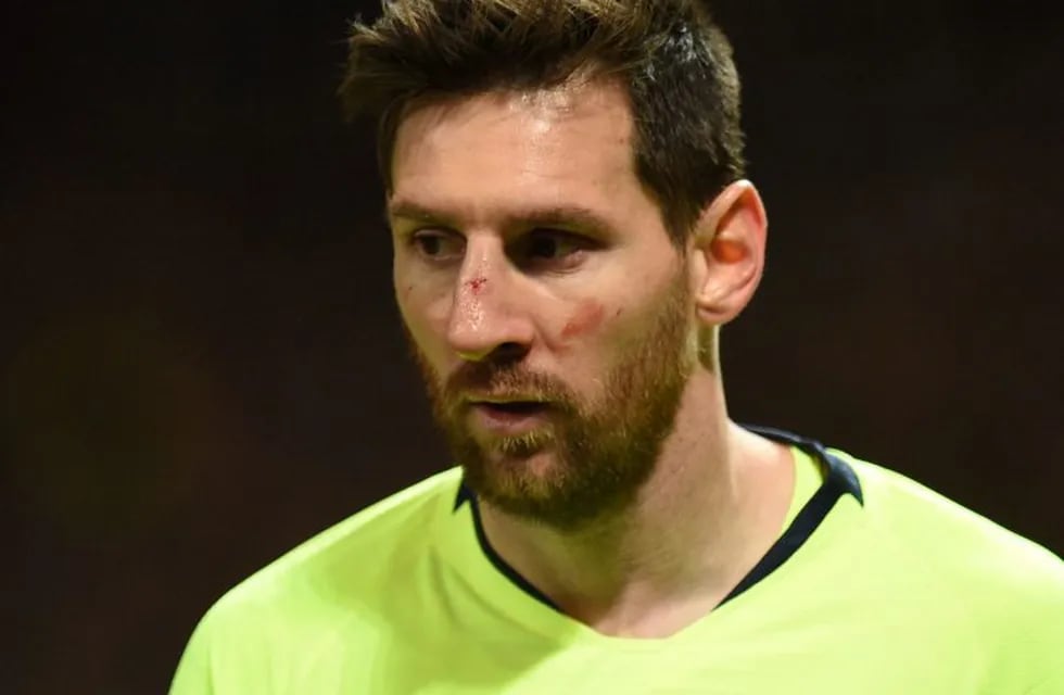 Lionel Messi, sin lesión tras el golpe en la cara. (AFP)