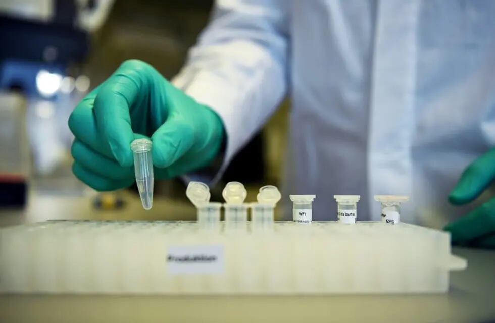 FILE PHOTO: An employee of German biopharmaceutical company CureVac, demonstrates research workflow on a vaccine for the coronavirus (COVID-19) disease at a laboratory in Tuebingen, Germany, March 12, 2020. REUTERS/Andreas Gebert/File Photo