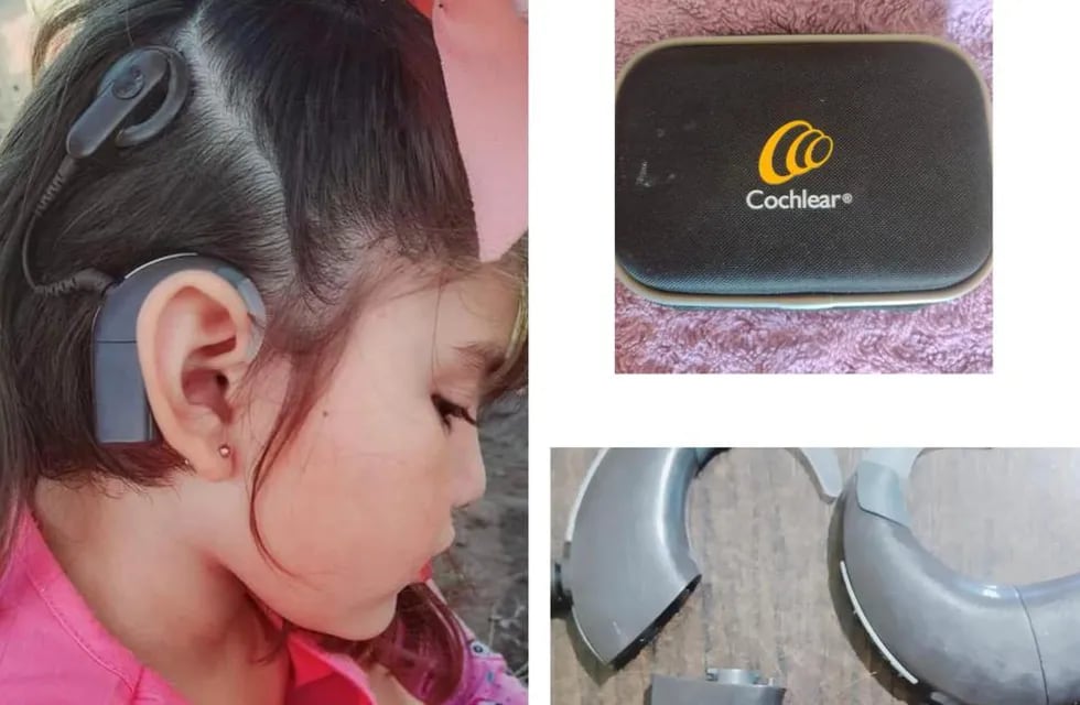 Robaron un estuche que contenía las baterías del implante que usa una nena de 5 años para poder escuchar.