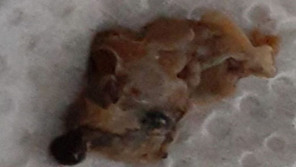 Una mujer encontró dentro de una lata de cerveza restos que se asemejan a un roedor. (Rosario3)