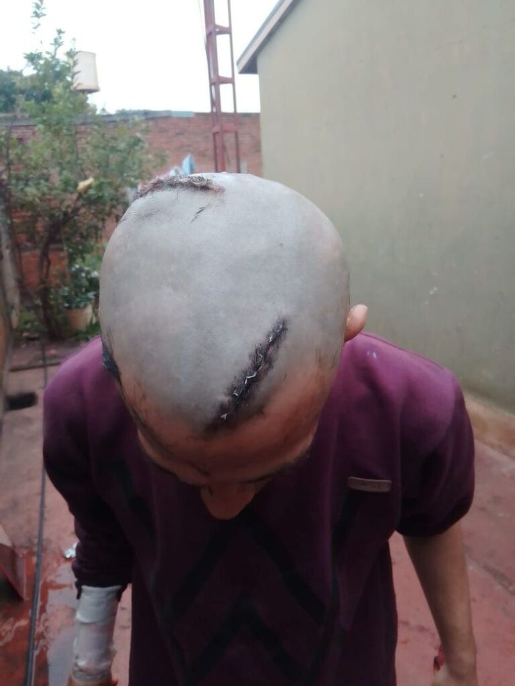 Salvaje ataque a machetazos en el barrio Fátima dejó cuatro hermanos lesionados.