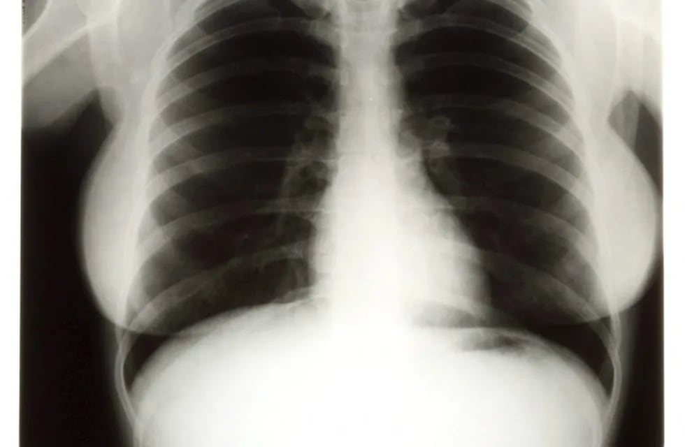 Radiografía. Imagen ilustrativa.
