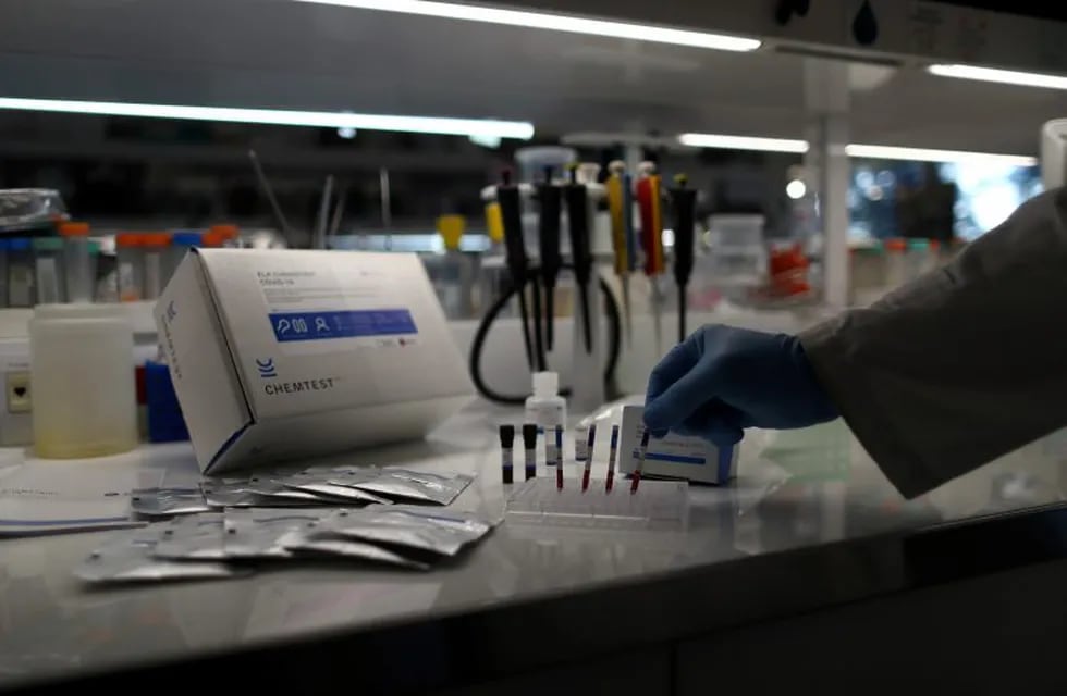 Se reportaron 21 muertes y 374 nuevos casos de coronavirus en las últimas 24 horas. REUTERS/Agustin Marcarian