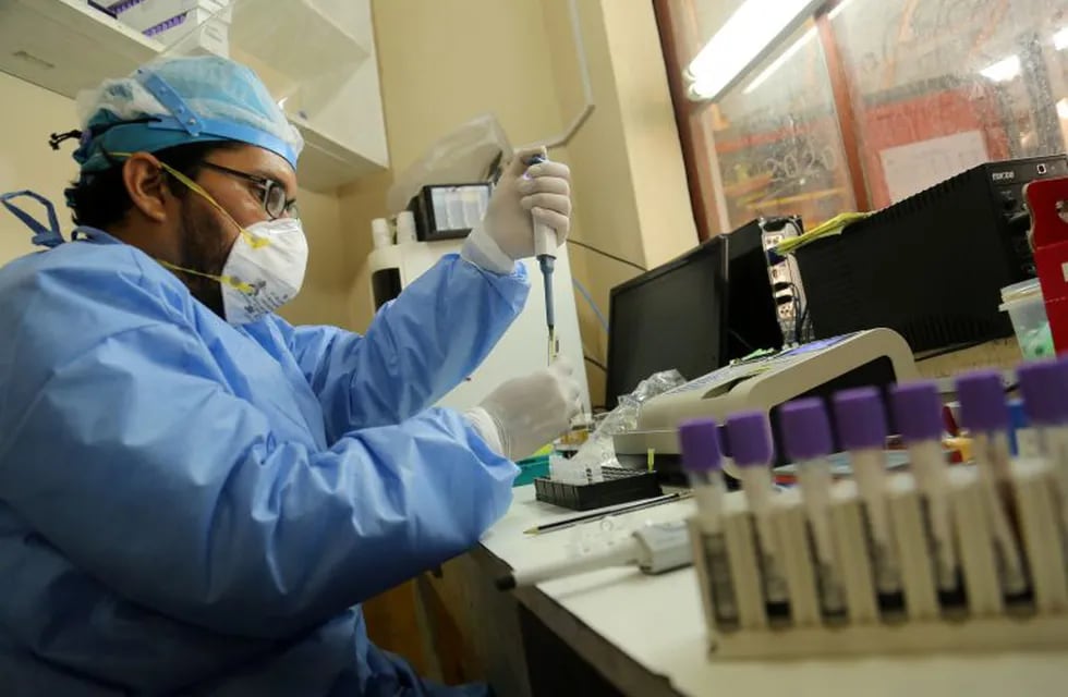 A lab technitian works on blood samples at the Cesar Garayar support hospital in the city of Iquitos, in the Amazon basin, on May 22, 2020, dedicated to endemic diseases like dengue, malaria, chikunguya and leptospirosis that still affect the population in addition to the arrival of the novel coronavirus that has claimed the lives of 14 doctors at this facility, not dedicated to harbor Covid19 cases. - Focused attention on fighting the new coronavirus in Peru has detracted the ability to combat the dengue fever, an explosive situation in the Amazon region, where it is leaving a trail of disease and death in cities and remote indigenous villages. (Photo by Cesar Von BANCELS / AFP)