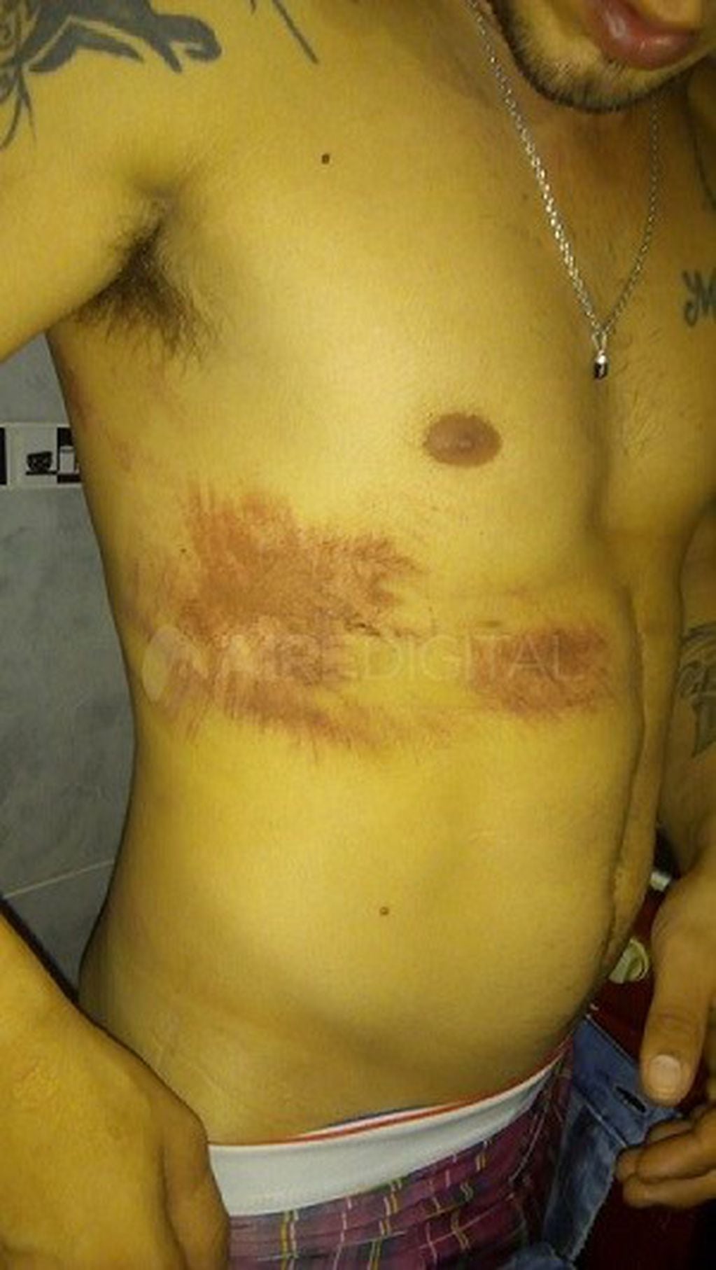 Las lesiones que mostró uno de los jóvenes supuestamente agredidos por la policía.