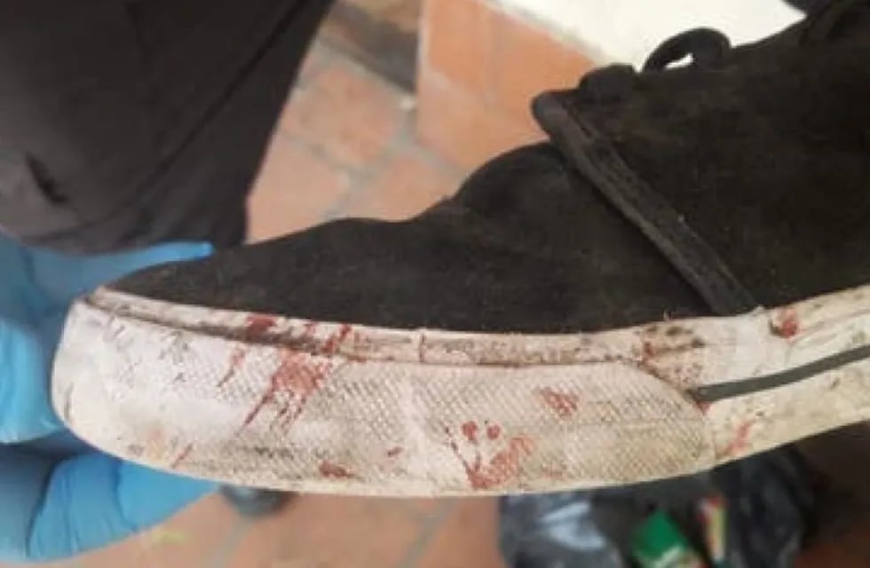 Crimen de Fernando Báez Sosa. La zapatilla sometida a una scopometría.