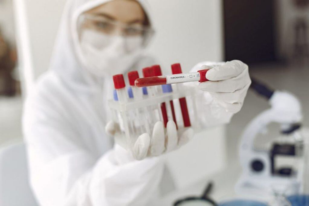Una investigadora mostrando pruebas de muestras de coronavirus. (DPA)