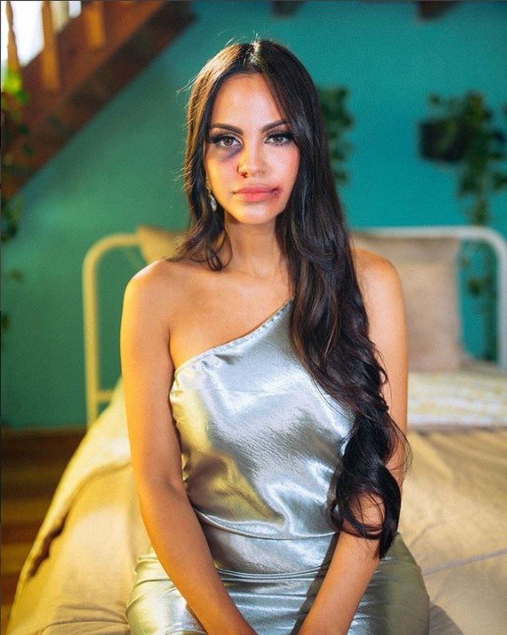 La foto que publicó Natti Natasha para promocionar su canción "Me estás matando".