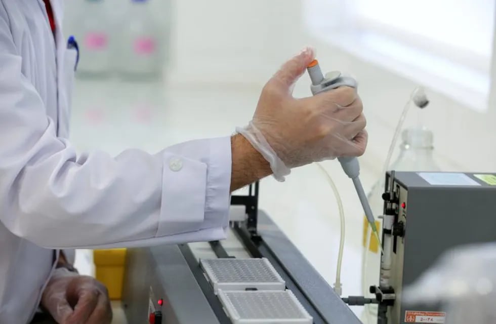 An Iranian doctor works on the production of COVID-19 test kits at a medical center in Karaj, in the northern Alborz Province, on April 11, 2020. - Iran reported 125 new deaths from the novel coronavirus, raising the overall toll in the Middle East's worst-hit country to 4,357. (Photo by ATTA KENARE / AFP)