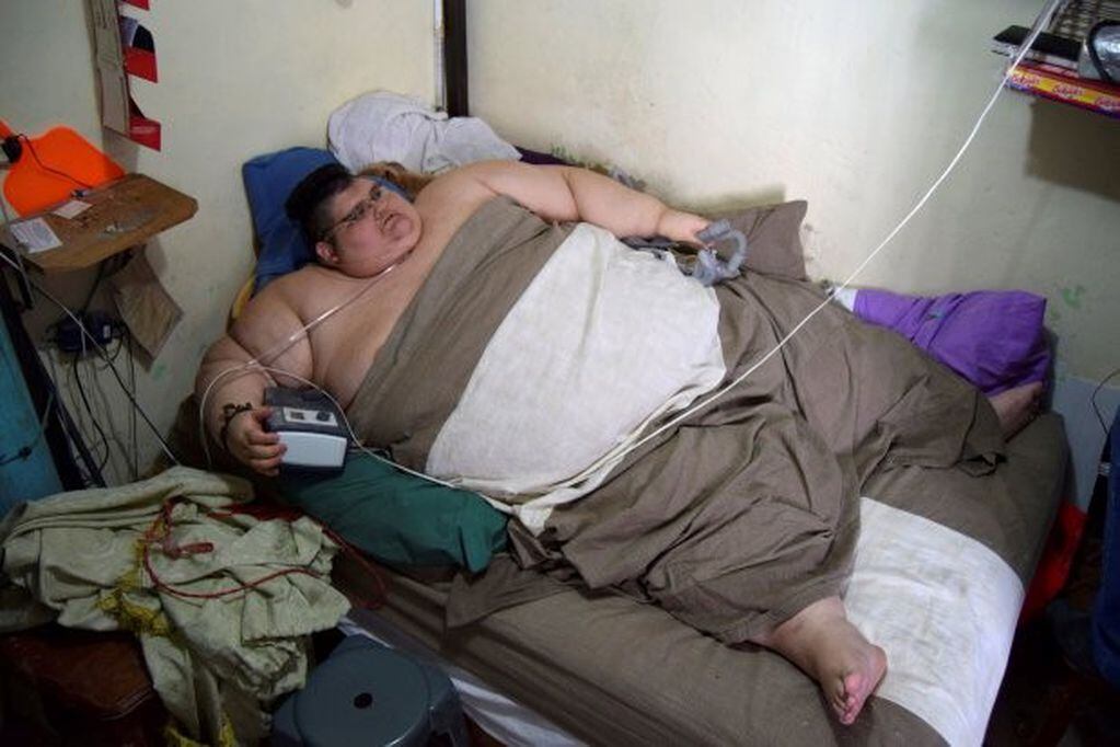 Juan Pedro Franco Salas, el hombre más obeso del mundo.