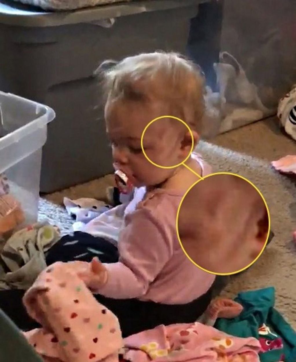 Heather Brough compartió en sus redes sociales un video espeluznante: su hija Lily Higgins estaba durmiendo en su habitación cuando una figura fantasmal apareció y le provocó tres lesiones en la cara.