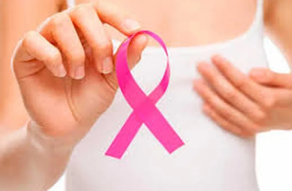 Oberá: el hospital Samic informa que  el servicio de mamografía funciona todos los días