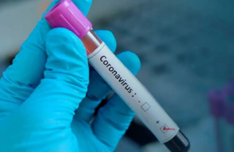 Primer caso positivo de coronavirus en La Pampa (Web)