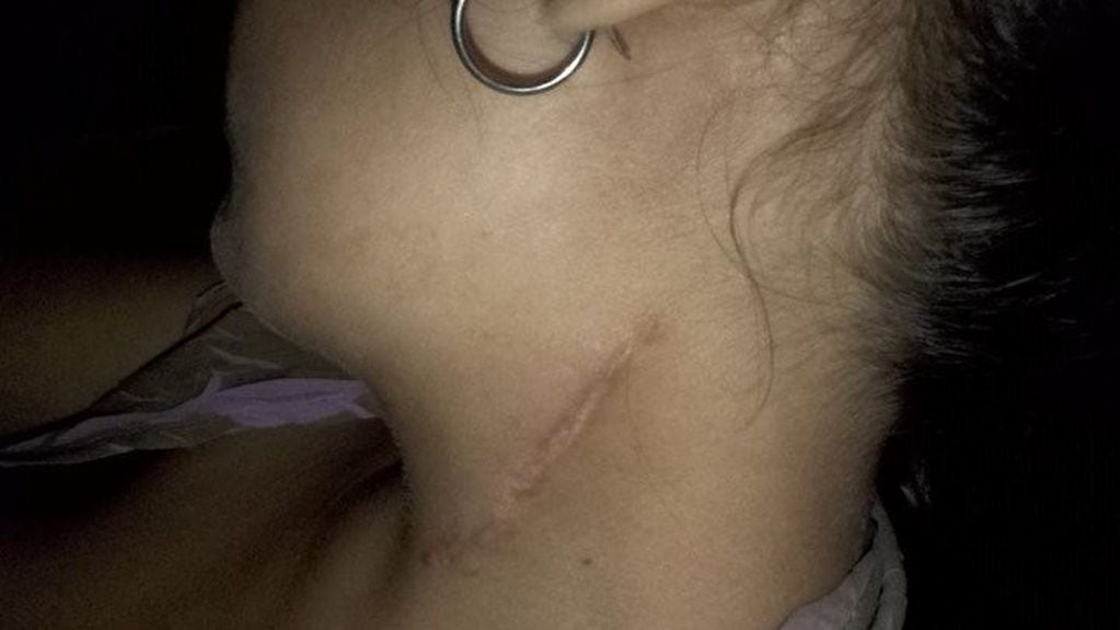 Una joven de 23 años casi muere en una operación de amigdalas en Paraná